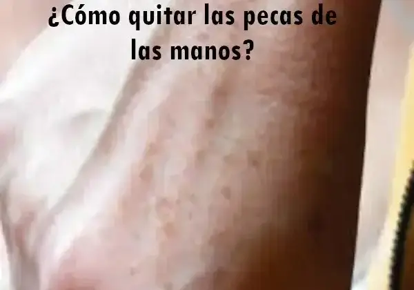 ¿Cómo quitar las pecas de las manos?
